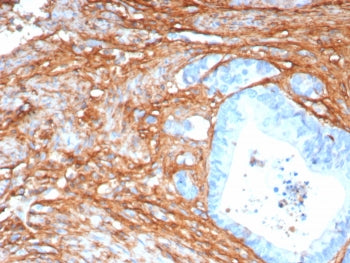 IHC staining of FFPE human colon tissue with Periostin antibody (clone POSTN/8165R). HIER: boil tiss