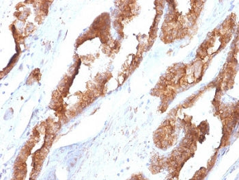 IHC staining of FFPE human prostate tissue with HSP27 antibody (clone CPTC-HSPB1-2). HIER: boil tiss