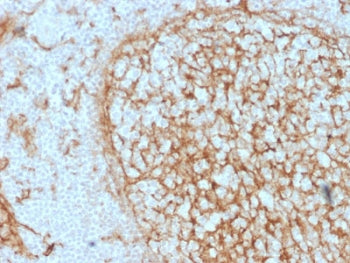 IHC testing of FFPE human tonsil with CD14 antibody (clone LPSR/2397). HIER: boil tissue sections in