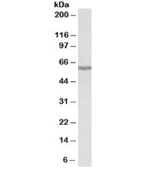 Western blot testing of human liver lysate with Fibrinogen beta chain antibody at 0.01ug/ml. Predict