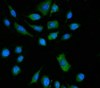 Immunofluorescent staining of FFPE mouse RM-1 cells with Zbp1 antibody (green) and DAPI nuclear stai