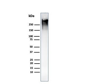 Western blot testing of human MCF7 cell lysate with recombinant Mucin-1 antibody (clone MUC1/1887R).