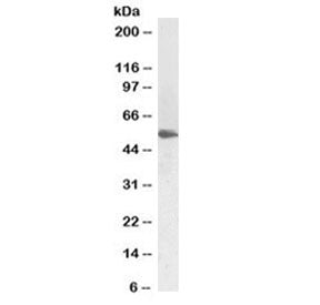 Western blot testing of human testis lysate with LCAT antibody at 1ug/ml. Observed molecular weight: