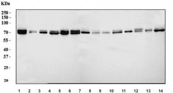 FACL4/ACSL4 Antibody