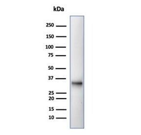 CD20 Antibody