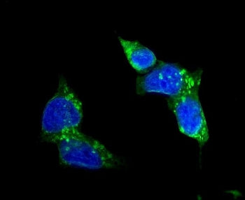 GLUT1 Antibody / SLC2A1