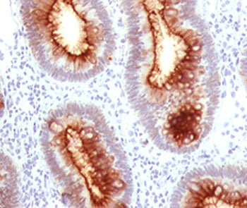 CEA Antibody / Carcinoembryonic Antigen