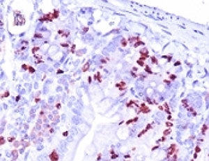 IHC analysis of formalin-fixed, paraffin-embedded mouse small intestine stained with BrdU antibody (