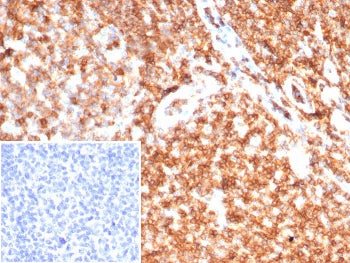 IHC staining of FFPE human tonsil tissue with CD45 antibody (clone rPTPRC/7275). Inset: PBS used in 
