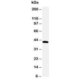 Western blot testing of Podocin antibody and rat kidney tissue lysate. Predicted molecular weight ~4