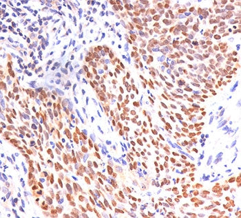 p40 / p63 delta Antibody