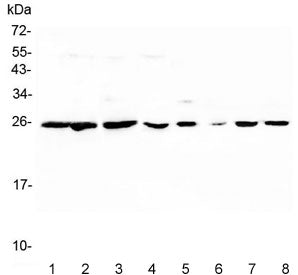 Western blot testing of 1) human placenta, 2) human PC-3, 3) human K562, 4) human HeLa, 5) rat lung,