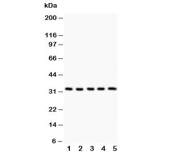 HSD11B1 Antibody