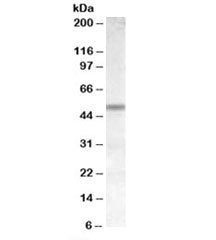 CHRNB3 Antibody