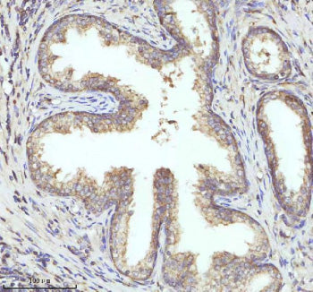 Immunohistochemical staining of PIPOX using anti-PIPOX antibody. PIPOX was detected in a paraffin-em