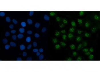 TMED5 Antibody / Transmembrane emp24 domain-containing protein 5