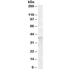 Western blot testing of human bone marrow lysate with DKK1 antibody at 1ug/ml. Predicted molecular w