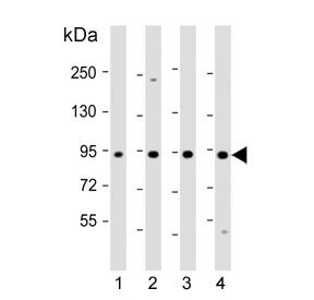 Western blot testing of human 1) HepG2, 2) HUVEC, 3) Jurkat and 4) K562 cell lysate with Ras-interac