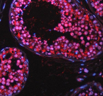 Immunofluorescent staining of TAOK2 using anti-TAOK2 antibody (red). TAOK2 was detected in a paraffi