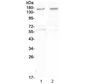 Western blot testing of human 1) U-87 MG and 2) SHG-4 cell lysate with Neurexin antibody at 0.5ug/ml