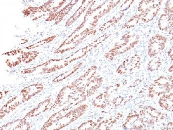 Retinoblastoma Antibody / Rb1