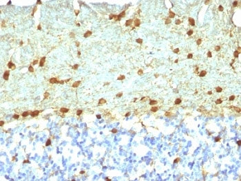 IHC: Formalin-fixed, paraffin-embedded rat brain stained with Fascin antibody (FSCN1/418)