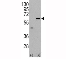 Western blot analysis of AKT3 antibody and 293 cell lysate (2 ug/lane) either nontransfected (Lane 1