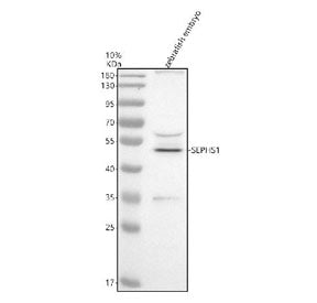 Western blot analysis of Sephs1 protein using Zebrafish Sephs1 antibody and zebrafish embryo tissue 