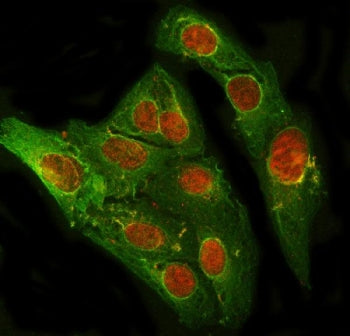 Immunofluorescent staining of FFPE human U-2 OS cells with PRDM2 antibody (red) and Beta Tubulin mAb