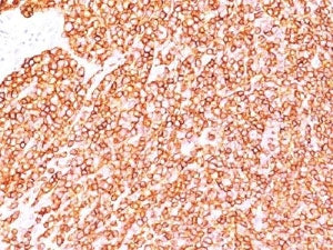 CD45 Antibody (Leukocyte marker)