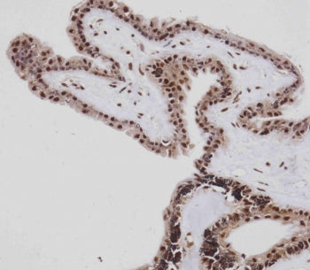 IHC testing of FFPE human retina with Retinoblastoma antibody. HIER: steam section in pH9 EDTA for 2