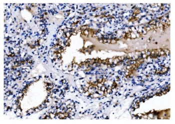 CD13 Antibody / ANPEP