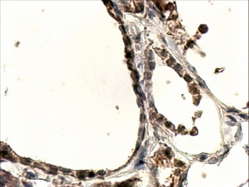 IHC testing of FFPE human thyroid gland with DUOX1 antibody at 4ug/ml. HIER: steamed with pH9 Tris/E