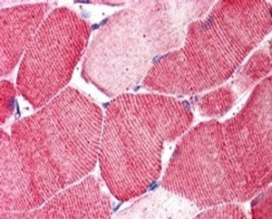 IHC staining of FFPE human skeletal muscle with ARSB antibody at 5ug/ml. HIER: steamed with pH6 citr