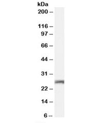 Western blot testing of mouse brain lysate with Connexin 26 antibody at 0.01ug/ml. Predicted molecul