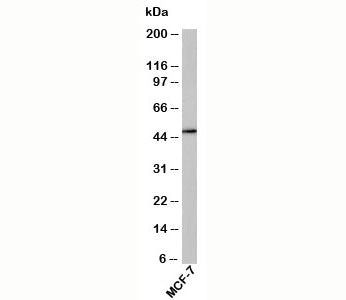 Western blot testing of human samples with RUNX2 antibody at 1ug/ml. Predicted molecular weight: 50-