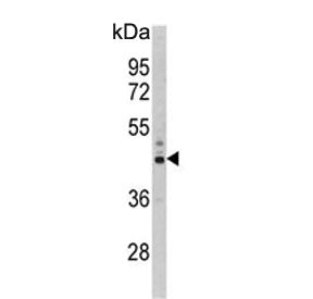 Western blot testing of human Y79 cell lysate with PSMD13 antibody. Predicted molecular weight ~43 k