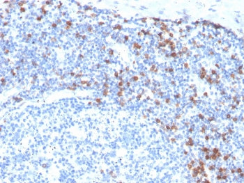 IHC staining of FFPE human tonsil with recombinant Integrin alpha E antibody (clone ITGAE/3904R). HI