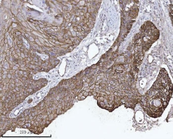 p120 Catenin Antibody / CTNND1 / Catenin delta 1