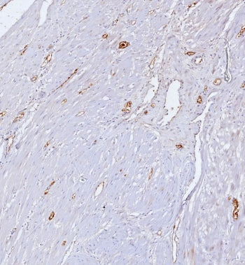 IHC staining of FFPE human uterus tissue with CD34 antibody (clone CD34/7717). HIER: boil tissue sec