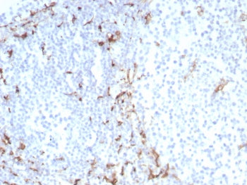 IHC staining of FFPE human tonsil tissue with CD163 antibody (clone M130/8822R). HIER: boil tissue s