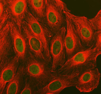 Immunofluorescent staining of FFPE human U-2 OS cells with Cyclin D1 antibody (green) and Alpha Tubu
