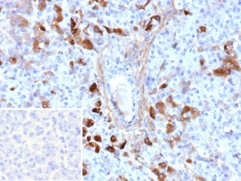 IHC staining of FFPE human pancreas tissue with GC antibody (clone VDBP/9980). Inset: PBS used in pl