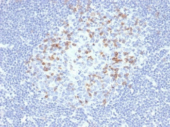 IHC staining of FFPE human lymph node tissue with PD1 (CD279) antibody (clone PDCD1/4231R). HIER: bo