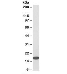 Western blot testing of HeLa cell lysate with IFITM3 antibody at 1ug/ml. Predicted molecular weight: