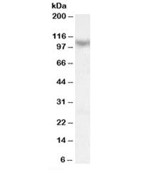 Western blot testing of human skeletal muscle lysate with MAML1 antibody at 0.1ug/ml. Predicted mole