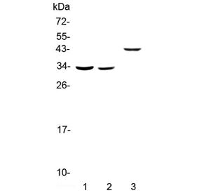 Western blot testing of 1) rat liver, 2) mouse liver and 3) human SMMC-7721 lysate with Regucalcin a