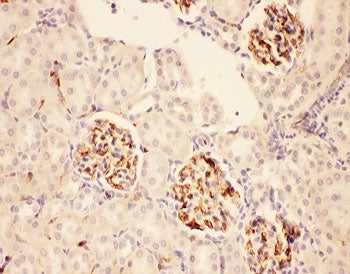ACTH Antibody