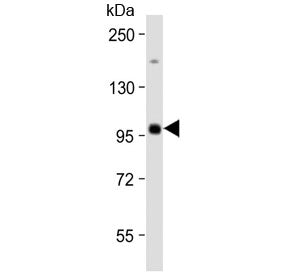 Western blot testing of human Raji cell lysate with MAP4K1 antibody at 1:2000. Predicted molecular w