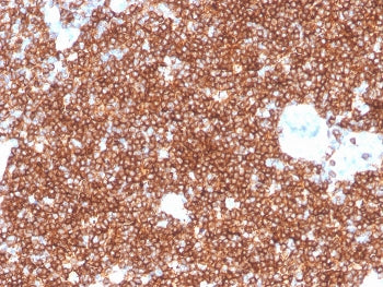 IHC staining of FFPE human tonsil with recombinant CD4 antibody. HIER: boil tissue sections in pH 9 